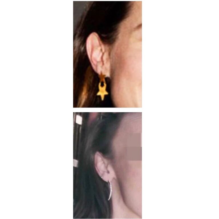 Read more about the article Do these ears appear to belong to the same person in your opinion? Secondly, can