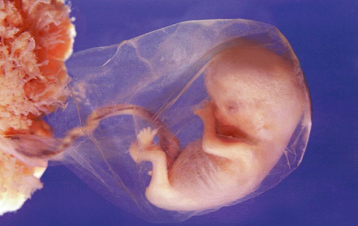 Read more about the article Scientists Want to Grow Babies in the Womb for Over a Month and Kill Them for Re