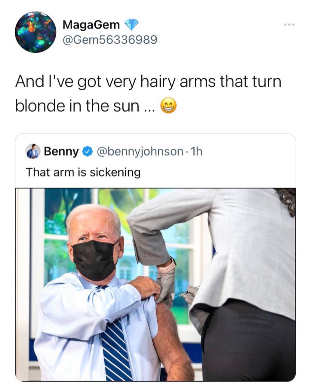You are currently viewing Why is it so hairy