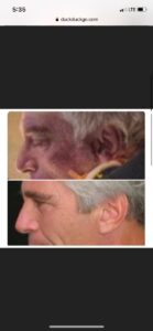 Read more about the article I still believe that Epstein’s “cadaver” was Tony Rodham, HRC’s brother.