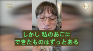 Read more about the article Vaccine damage: Canada’s Adele Strain has facial palsy after two doses – GNEWS