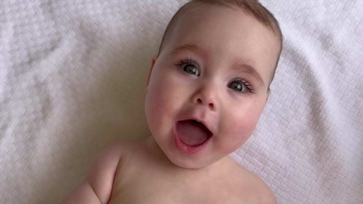 You are currently viewing Gerber introduces ‘spokesbaby’ born without femur